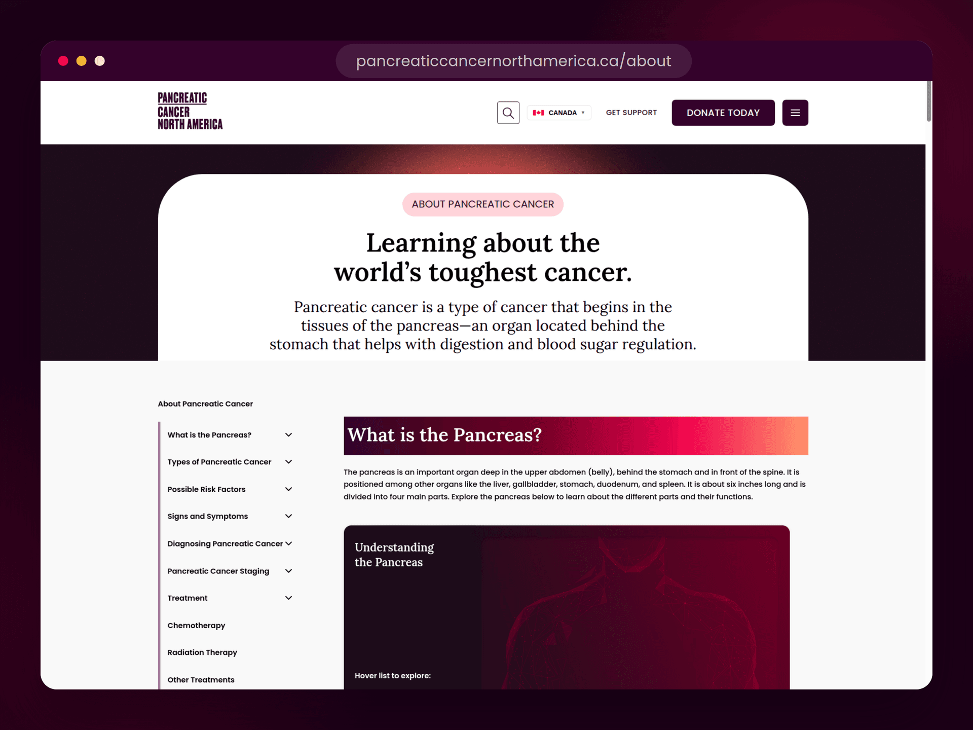 PCNA About Pancreatic Cancer page